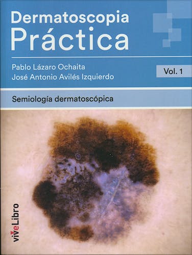 Portada del libro 9788417089399 Dermatoscopia Práctica, Vol. 1: Semiología Dermatoscópica