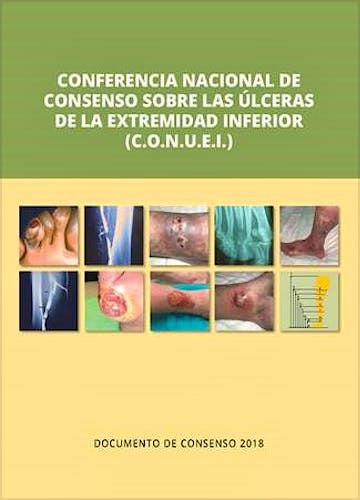 Portada del libro 9788417194260 Conferencia Nacional de Consenso sobre las Úlceras de la Extremidad Inferior (C.O.N.U.E.I.)