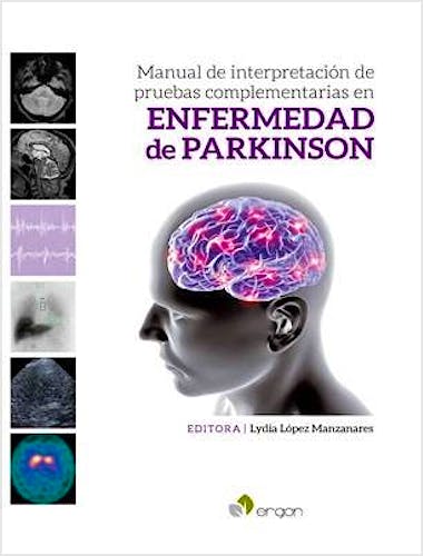 Portada del libro 9788417194727 Manual de Interpretación de Pruebas Complementarias en Enfermedad de Parkinson