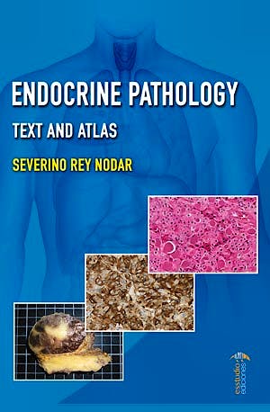 Portada del libro 9788417226725 Endocrine Pathology. Text and Atlas