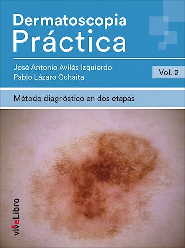 Portada del libro 9788417689834 Dermatoscopia Práctica, Vol. 2: Método Diagnóstico en Dos Etapas