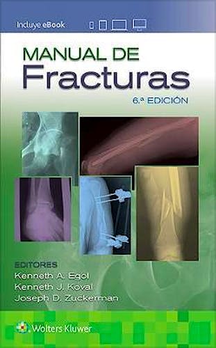 Portada del libro 9788417949440 Manual de Fracturas