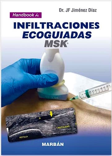 Portada del libro 9788418068645 Handbook de Infiltraciones Ecoguiadas MSK (Reimpresión 2021)