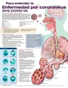 Para Entender la Enfermedad por Coronavirus 2019 (COVID-19)