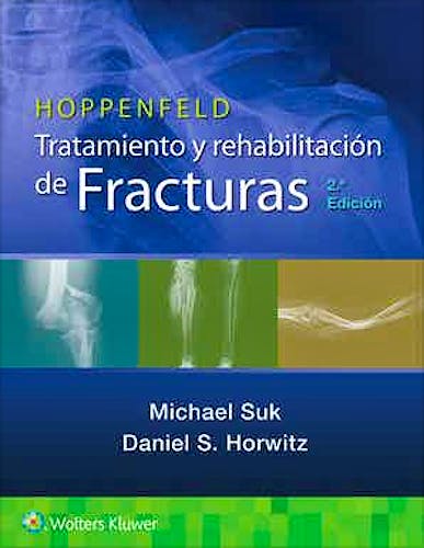 Portada del libro 9788418563898 HOPPENFELD Tratamiento y Rehabilitación de Fracturas