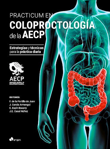 Portada del libro 9788418576485 Practicum en Coloproctología de la AECP. Estrategias y Técnicas para la Práctica Diaria