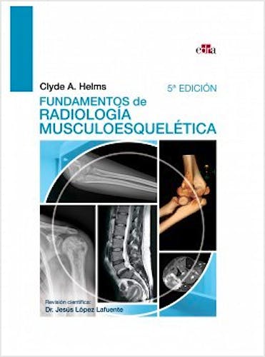 Portada del libro 9788418706080 Fundamentos de Radiología Musculoesquelética