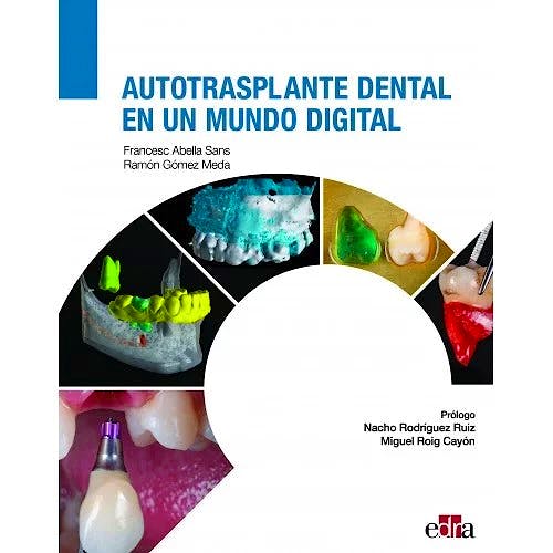 Portada del libro 9788419156044 Autotrasplante Dental en un Mundo Digital