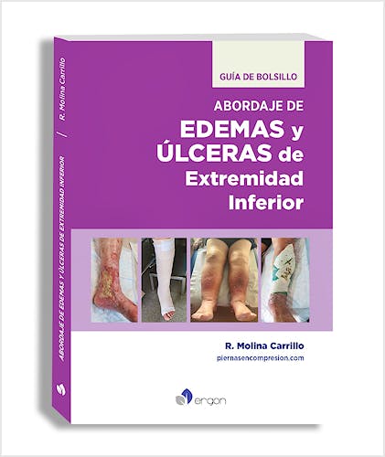 Portada del libro 9788419230966 Guía de Bolsillo Abordaje de Edemas y Úlceras de Extremidad Inferior