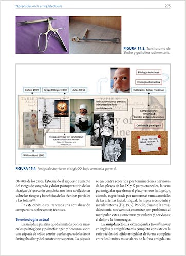 Portada del libro 9788419955777 Otorrinolaringología Pediátrica