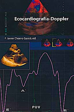 Portada del libro 9788437078892 Ecocardiografia-Doppler