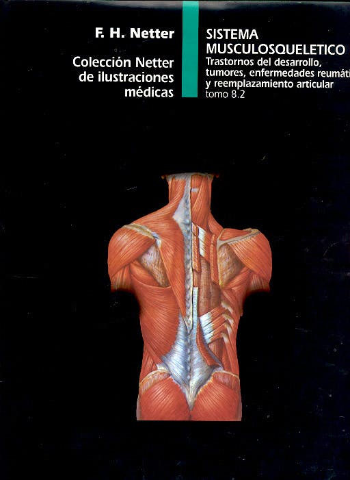 Portada del libro 9788445802229 Sistema Musculosquelético. Trastornos del Desarrollo, Tumores, Enfermedades Reumáticas y Reemplazamiento Articular. Colección Netter Tomo 8.2