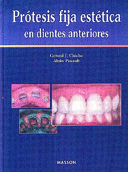 Portada del libro 9788445804414 Prótesis Fija Estética en Dientes Anteriores