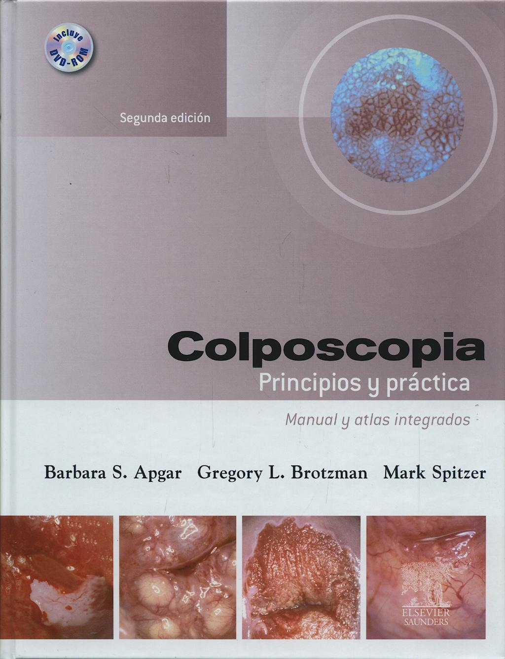 Portada del libro 9788445812761 Colposcopia. Principios y Práctica. Manual y Atlas Integrados