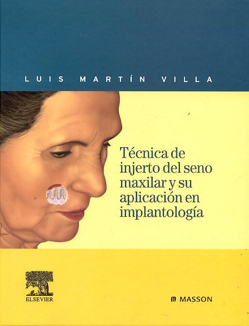 Portada del libro 9788445815168 Técnica de Injerto del Seno Maxilar y Su Aplicación en Implantología