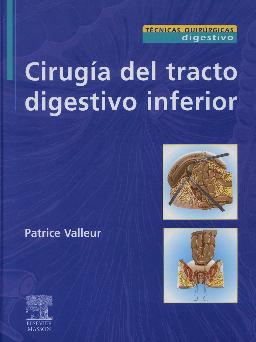 Portada del libro 9788445817728 Cirugia del Tracto Digestivo Inferior