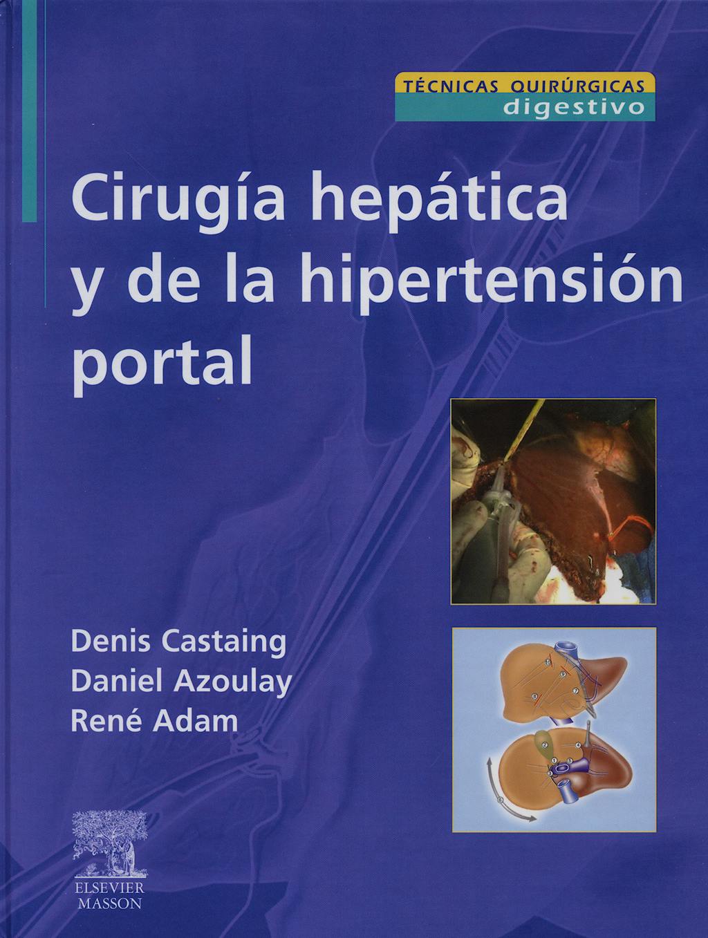 Portada del libro 9788445817735 Cirugia Hepatica y de la Hipertension Portal