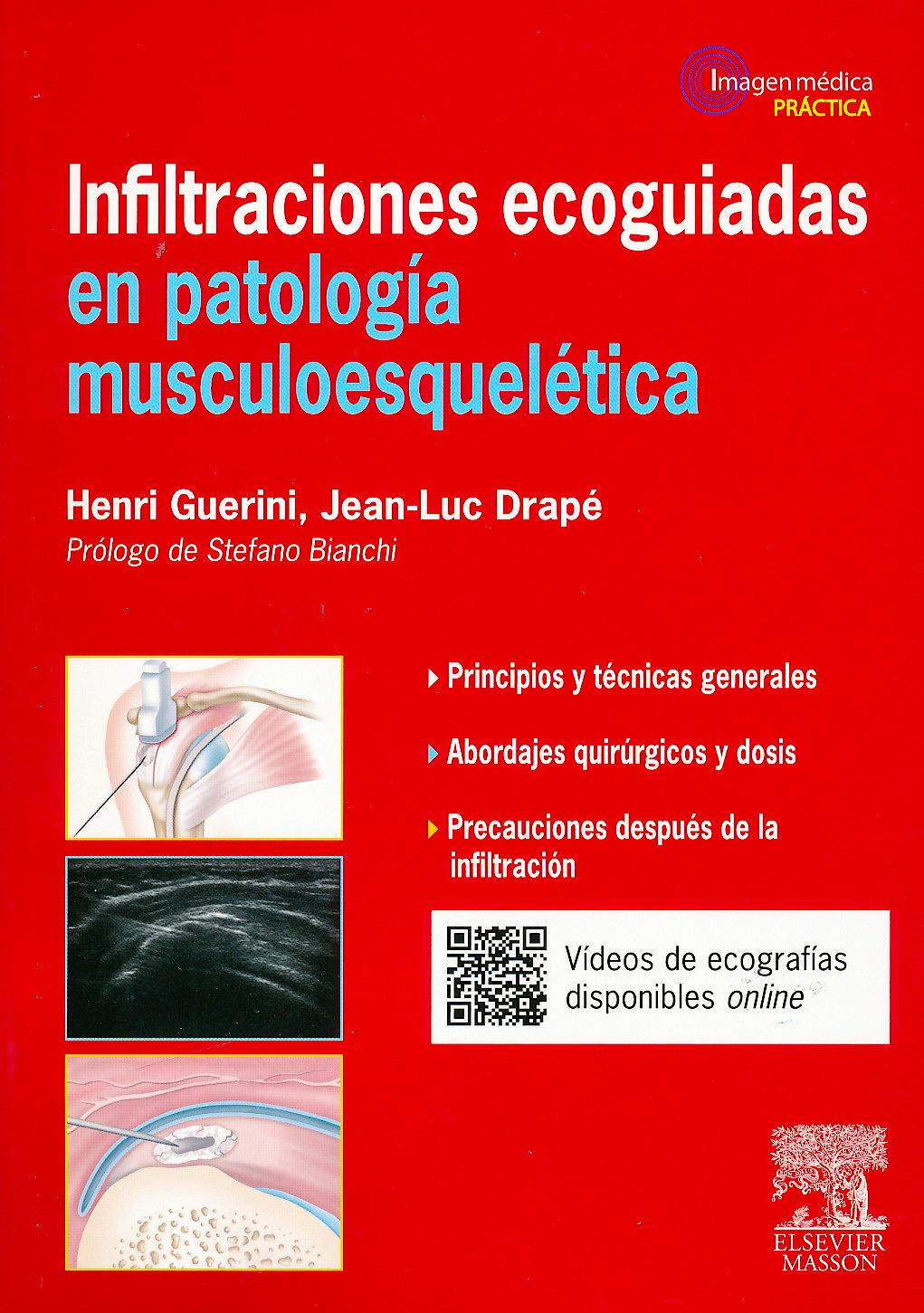 Portada del libro 9788445825297 Infiltraciones Ecoguiadas en Patología Musculoesquelética (Imagen Médica Práctica)