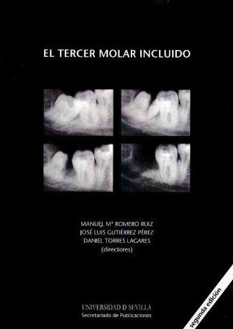 Portada del libro 9788447212569 El Tercer Molar Incluido