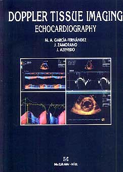 Portada del libro 9788448601874 Doppler Tissue Imaging Echocardiography