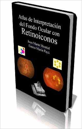 Portada del libro 9788460888338 Atlas de Interpretación del Fondo Ocular con Retinoiconos