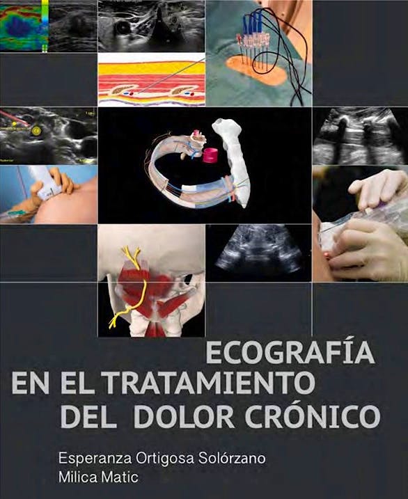 Portada del libro 9788460899679 Ecografía en el Tratamiento del Dolor Crónico