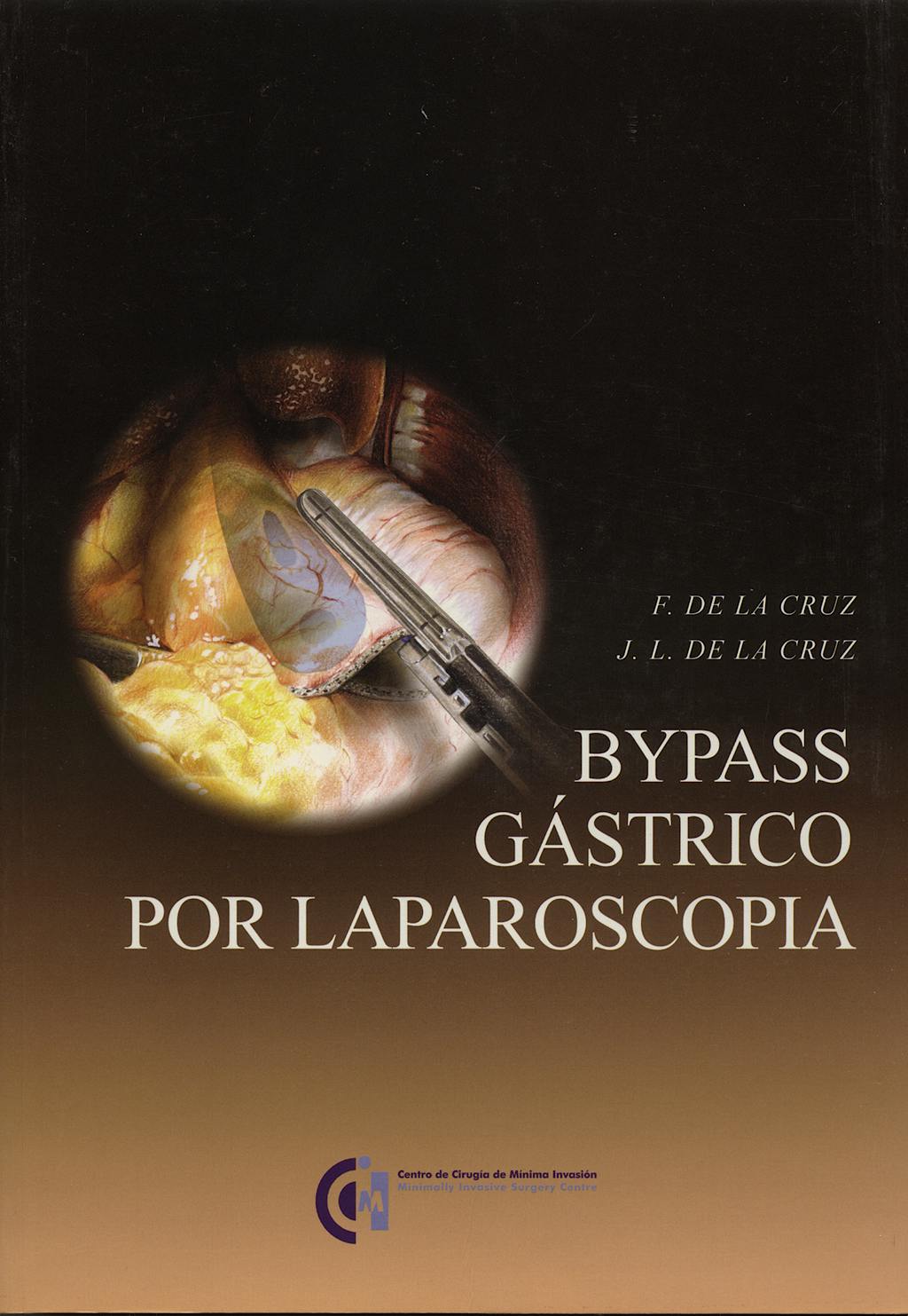 Portada del libro 9788460961024 Bypass Gastrico por Laparoscopia + Cd-Rom