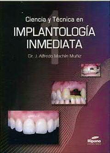 Portada del libro 9788461143535 Ciencia y Tecnica en Implantologia Inmediata, 2 Vols.