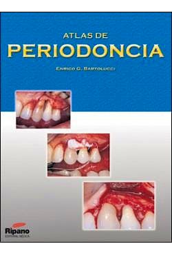 Portada del libro 9788461185429 Atlas de Periodoncia