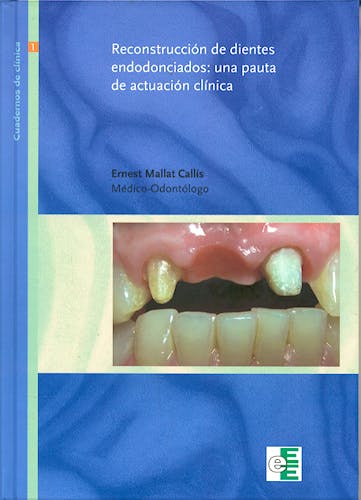 Portada del libro 9788461198542 Reconstrucción de Dientes Endodonciados: una Pauta de Actuación Clínica