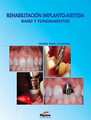 Portada del libro 9788461217861 Rehabilitacion Implanto-Asistida. Bases y Fundamentos