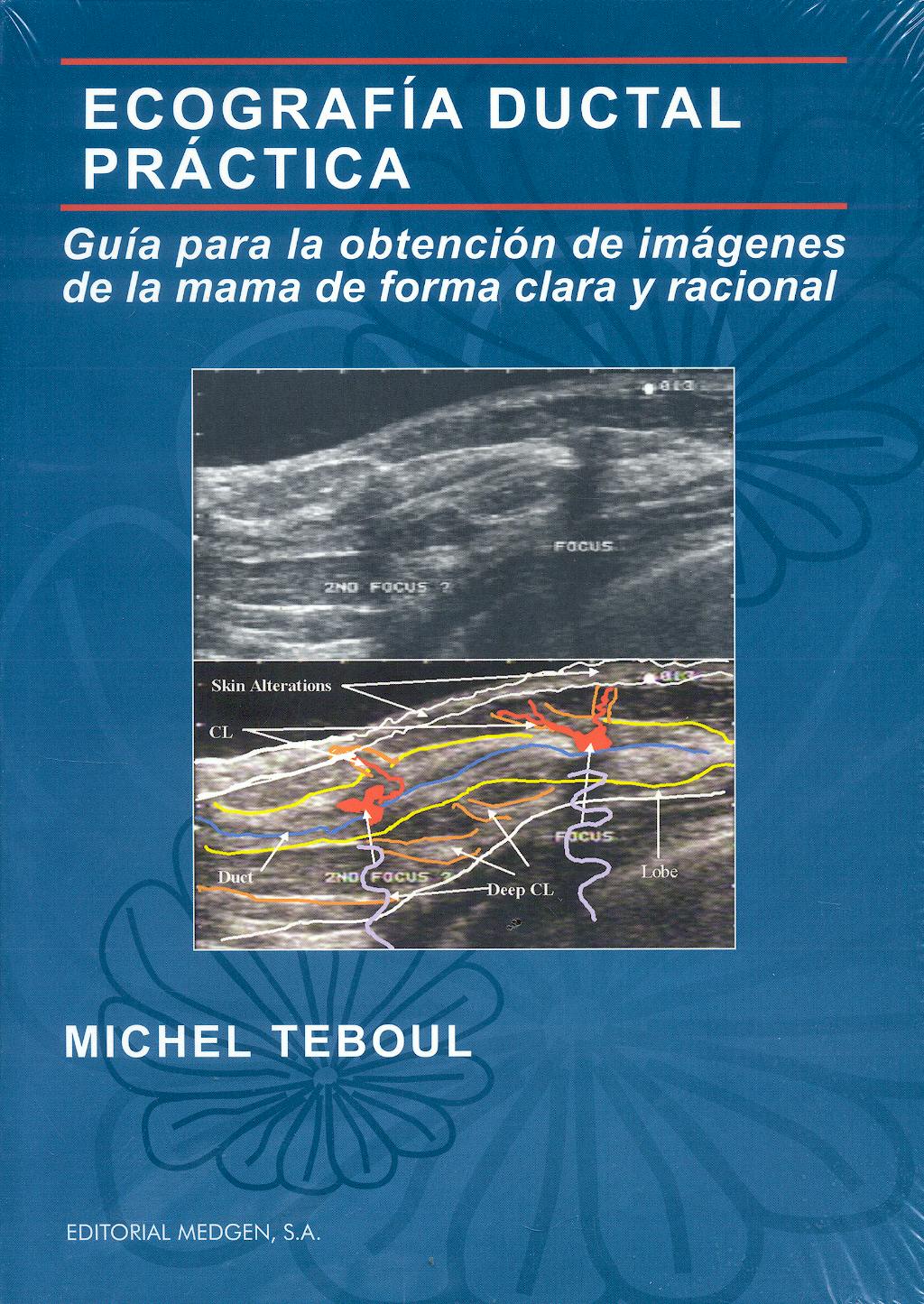 Portada del libro 9788461296439 Ecografia Ductal Practica. Guia para la Obtencion de Imagenes de la Mama de forma Clara y Racional
