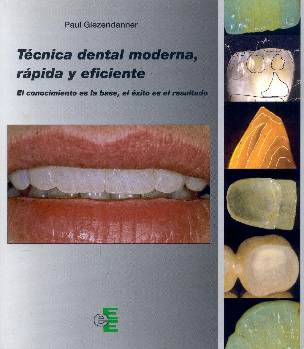 Portada del libro 9788461363827 Tecnica Dental Moderna, Rapida y Eficiente