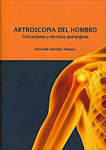 Portada del libro 9788469173381 Artroscopia del Hombro. Indicaciones y Técnicas Quirúrgicas