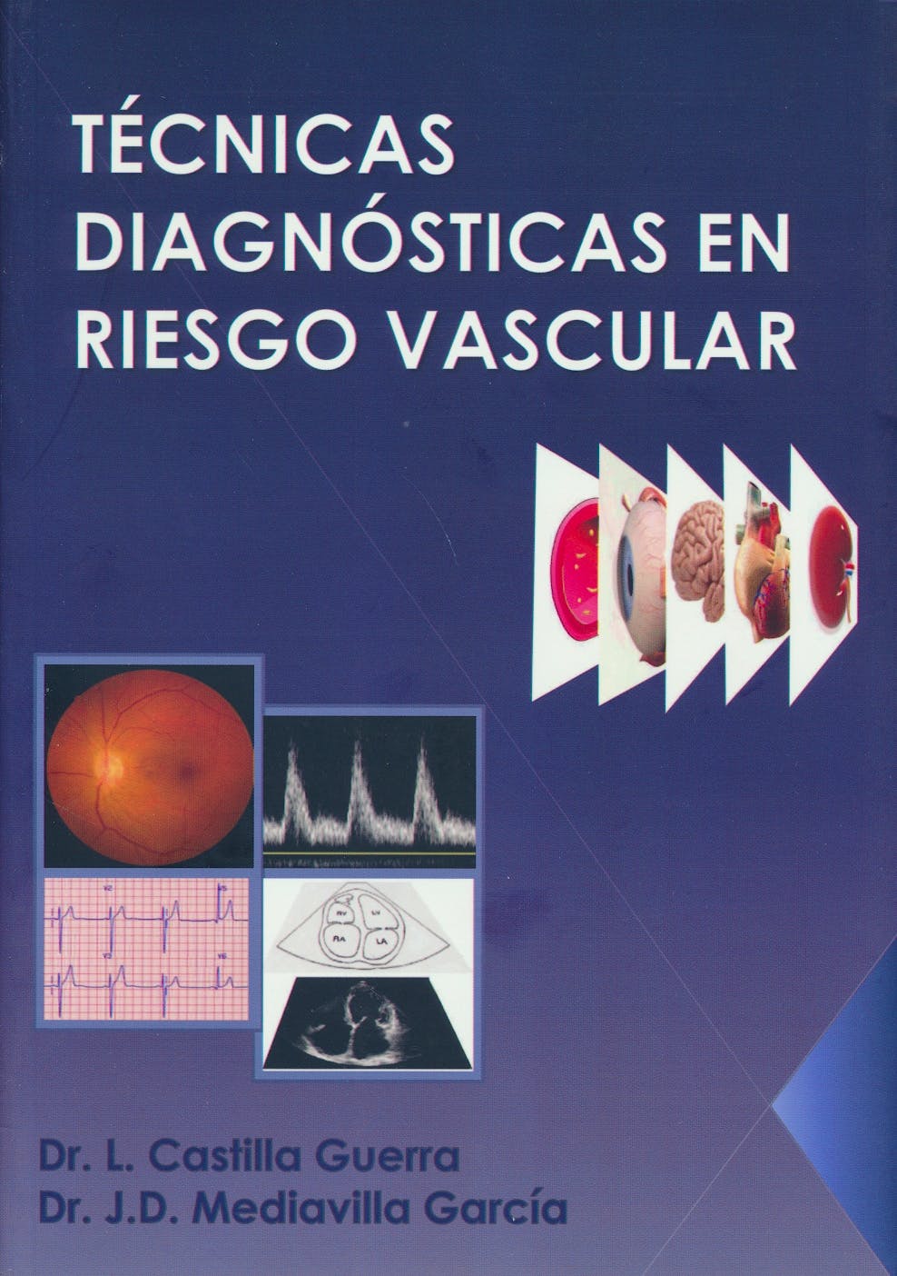 Portada del libro 9788469734698 Técnicas Diagnósticas en Riesgo Vascular
