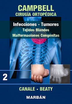 Portada del libro 9788471010728 CAMPBELL Cirugía Ortopédica Tomo 2: Infecciones. Tumores: Tejidos Blandos. Malformaciones Congénitas.