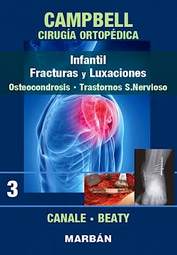 Portada del libro 9788471010919 CAMPBELL Cirugía Ortopédica, Tomo 3: Infantil. Fracturas y luxaciones: Osteocondrosis. Trastornos Sistema Nervioso