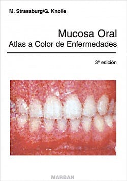 Portada del libro 9788471011848 Mucosa Oral. Atlas a Color de Enfermedades