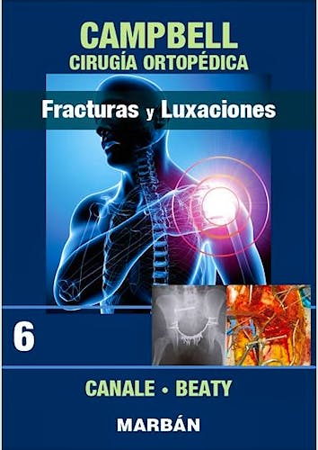 Portada del libro 9788471011930 CAMPBELL Cirugía Ortopédica, Tomo 6: Fracturas y Luxaciones.