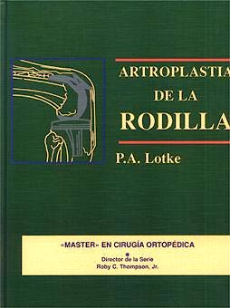 Portada del libro 9788471012258 Master en Cirugia Ortopedica: Artroplastia de la Rodilla