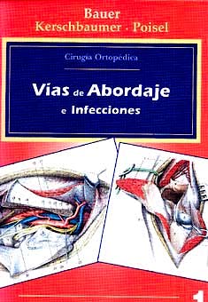 Portada del libro 9788471012326 Cirugía Ortopédica, Vol. 1: Vías de Abordaje e Infecciones
