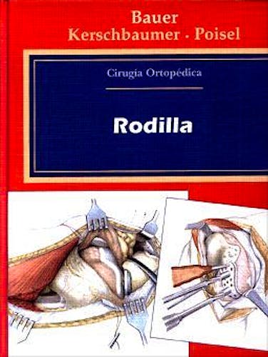 Portada del libro 9788471012333 Cirugia Ortopedica, Vol. 2: Rodilla