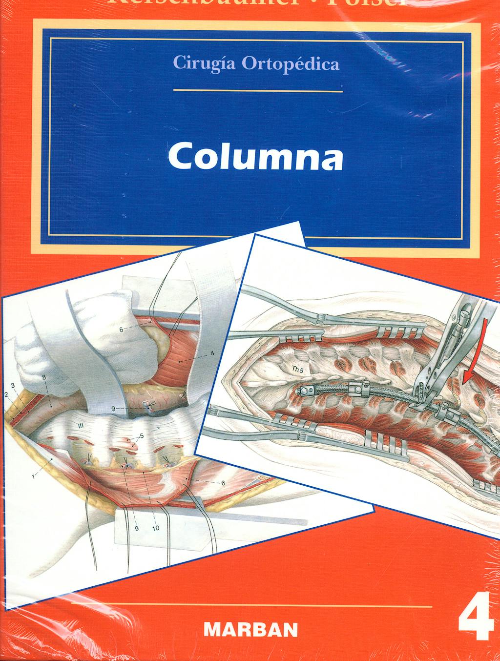 Portada del libro 9788471012395 Cirugia Ortopedica, Vol. 4: Columna
