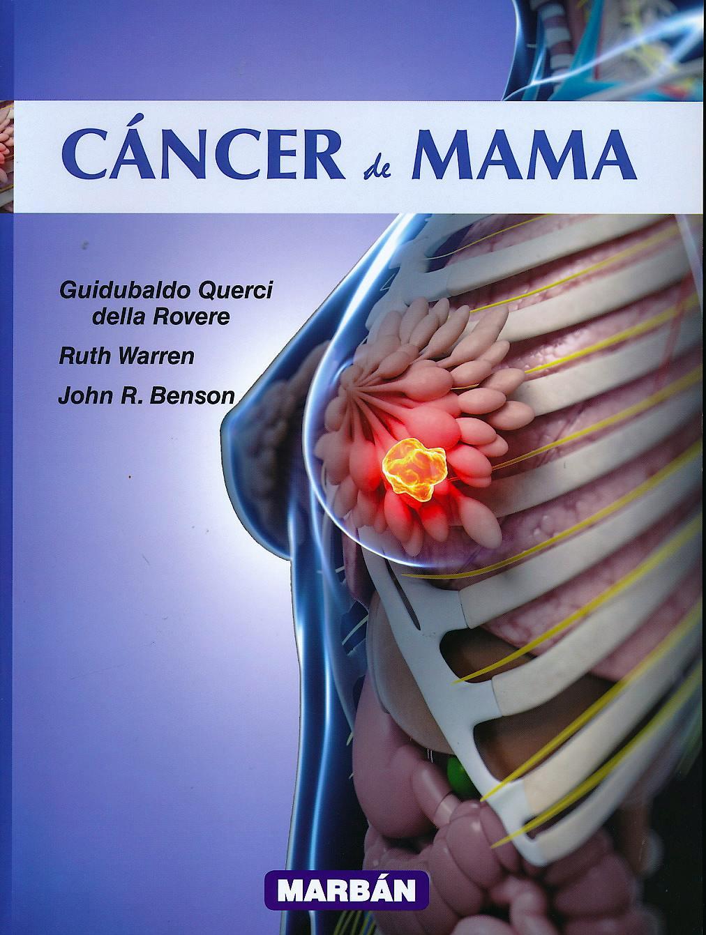 Portada del libro 9788471012623 Cáncer de Mama (Edición Premium)