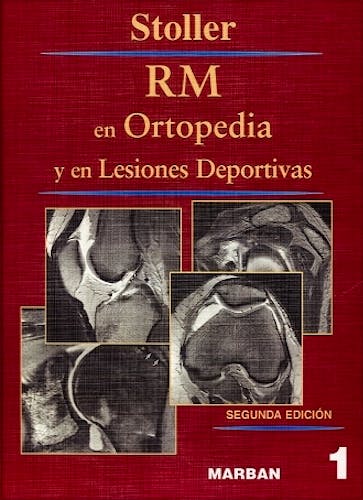 Portada del libro 9788471012869 RM en Ortopedia y en Lesiones Deportivas, Vol. 1