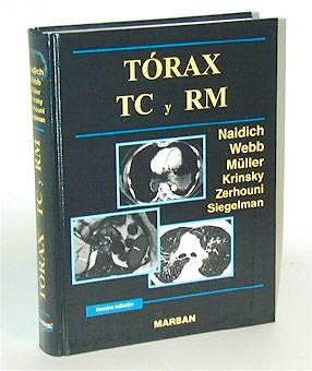 Portada del libro 9788471013224 Torax Tc y Rm