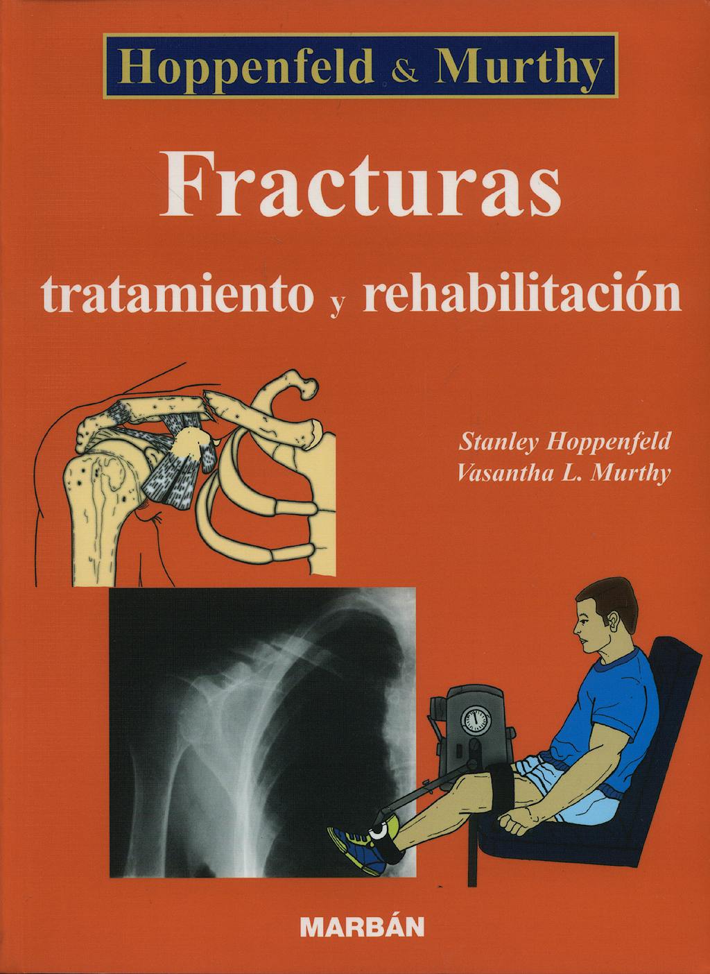 Portada del libro 9788471013408 Fracturas. Tratamiento y Rehabilitación