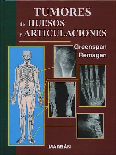 Portada del libro 9788471013637 Tumores de Huesos y Articulaciones