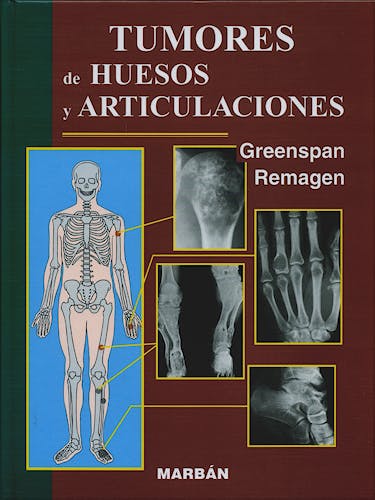 Portada del libro 9788471013637 Tumores de Huesos y Articulaciones