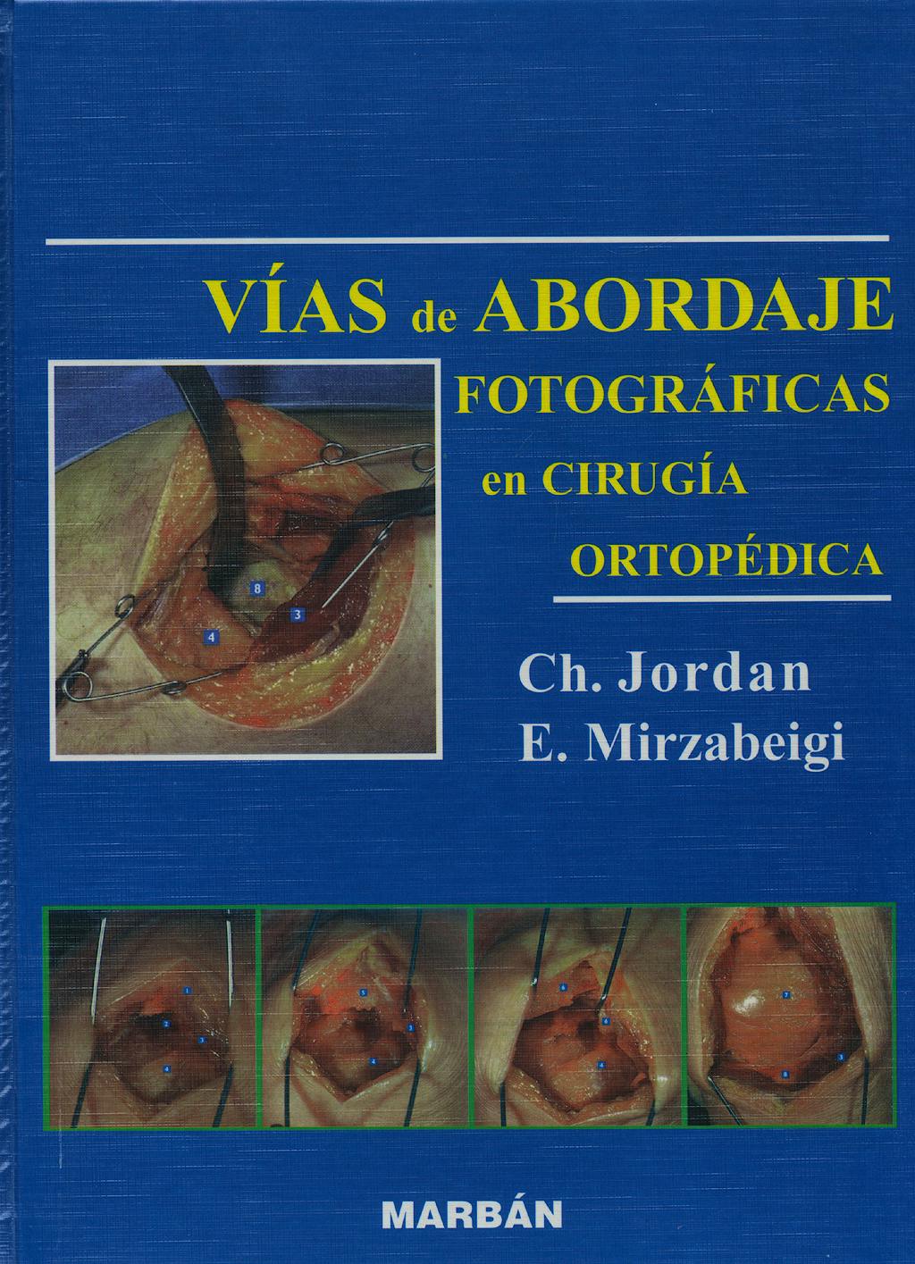 Portada del libro 9788471013644 Vías de Abordaje Fotográficas en Cirugía Ortopédica